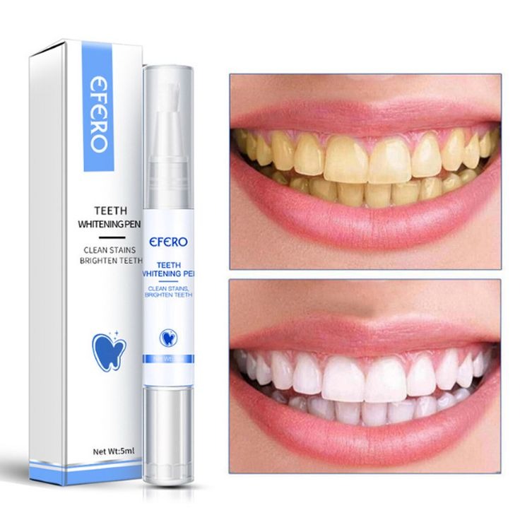 🔥 Teeth Whitening Pen – Professional Tooth Cleaning Serum to Remove Plaque, Yellow Stains & Whiten Teeth Instantly | Oral Hygiene Tool