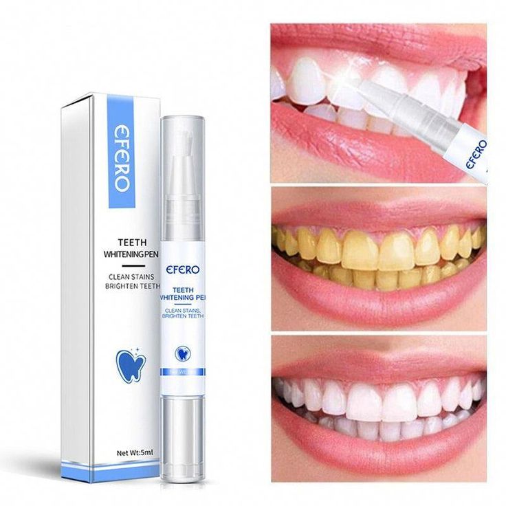 🔥 Teeth Whitening Pen – Professional Tooth Cleaning Serum to Remove Plaque, Yellow Stains & Whiten Teeth Instantly | Oral Hygiene Tool