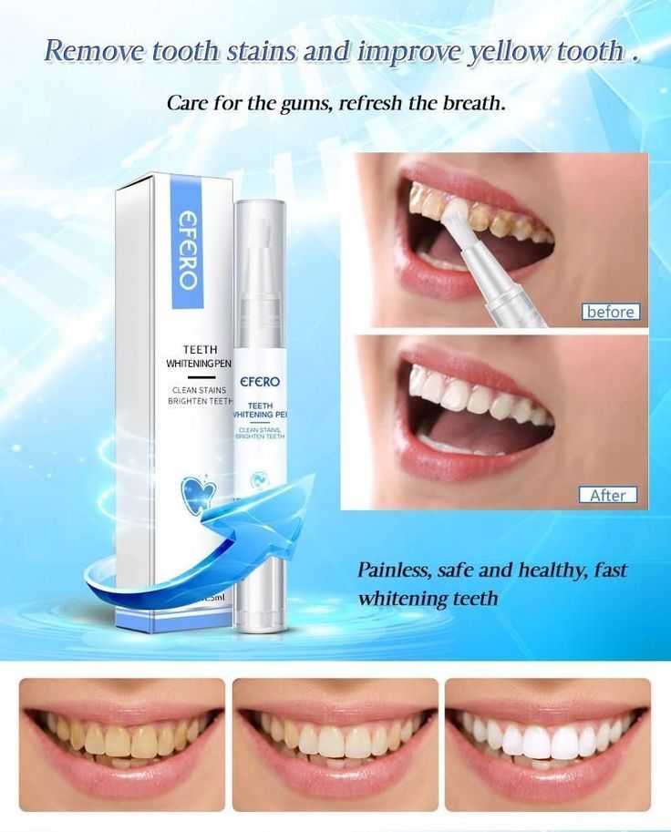 🔥 Teeth Whitening Pen – Professional Tooth Cleaning Serum to Remove Plaque, Yellow Stains & Whiten Teeth Instantly | Oral Hygiene Tool