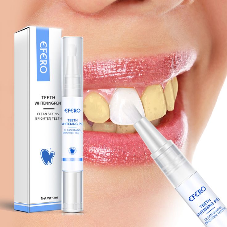 🔥 Teeth Whitening Pen – Professional Tooth Cleaning Serum to Remove Plaque, Yellow Stains & Whiten Teeth Instantly | Oral Hygiene Tool